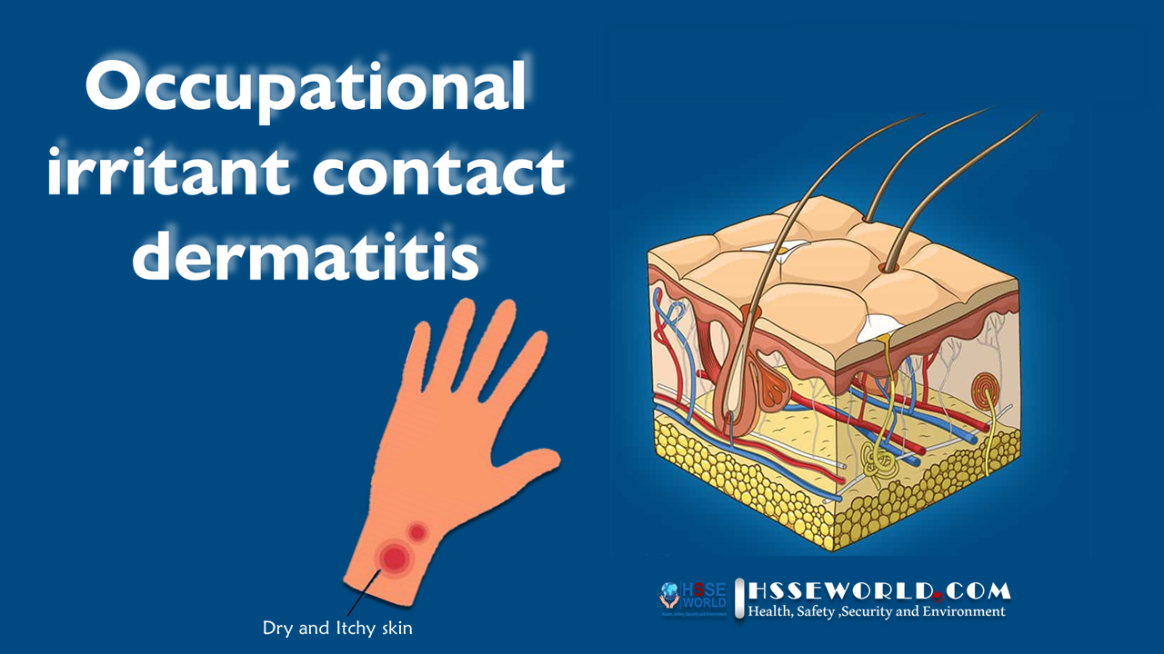 Occupational Contact Dermatitis HSSE WORLD