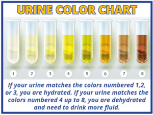 Urince Color chart - HSSE WORLD