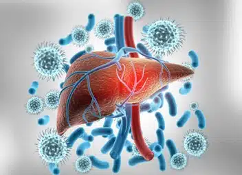Hepatitis A