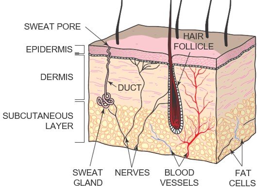 welding safety - First Degree burn